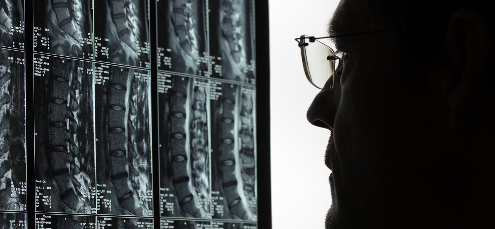 doctor looking at xray