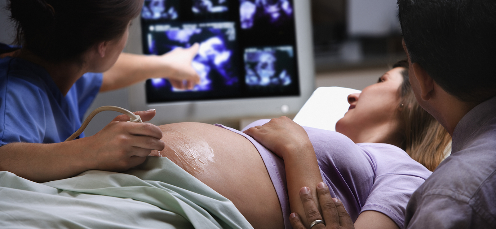 woman getting an ultrasound