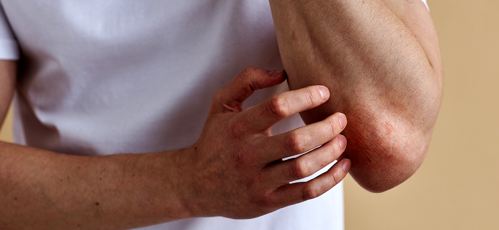 A photo of a person scratching their elbow.