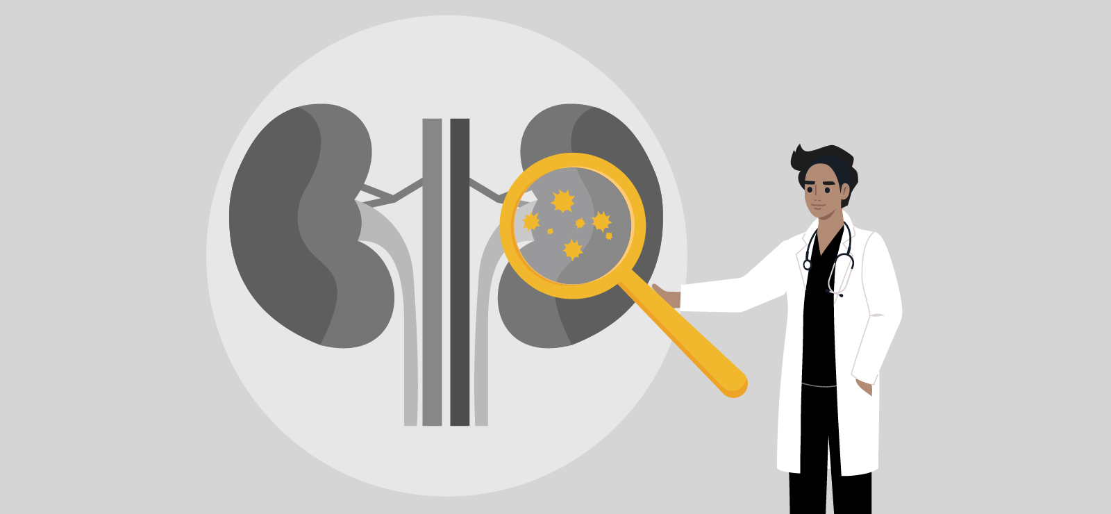A cartoon graphic of a physician pointing at some kidneys.