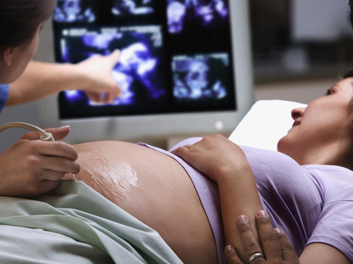 woman getting an ultrasound