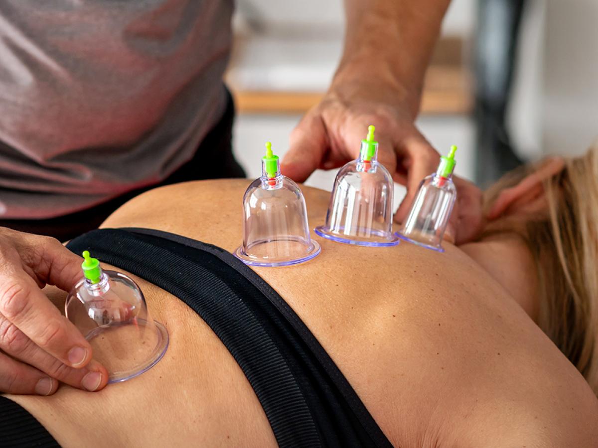 A photo of a woman receiving cupping therapy.