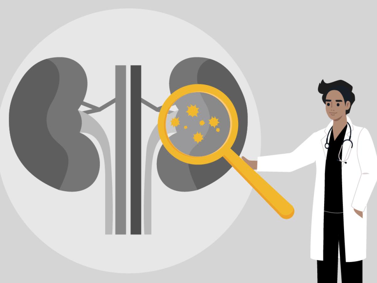 A cartoon graphic of a physician pointing at some kidneys.