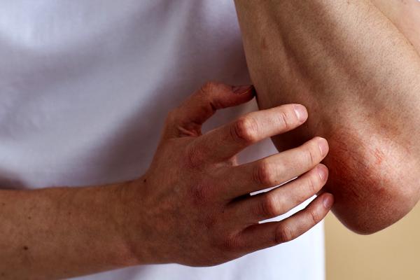 A photo of a person scratching their elbow.