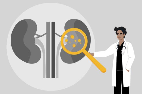 A cartoon graphic of a physician pointing at some kidneys.