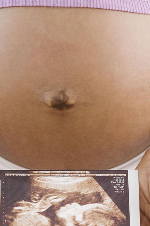 pregnant woman