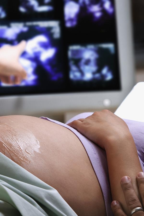 woman getting an ultrasound