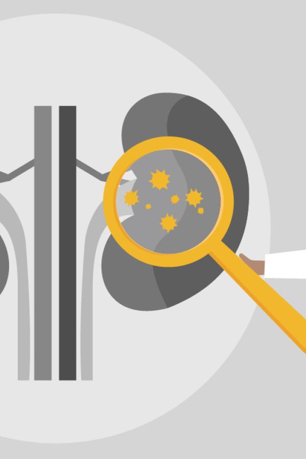 A cartoon graphic of a physician pointing at some kidneys.