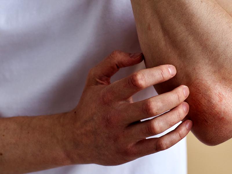 A photo of a person scratching their elbow.